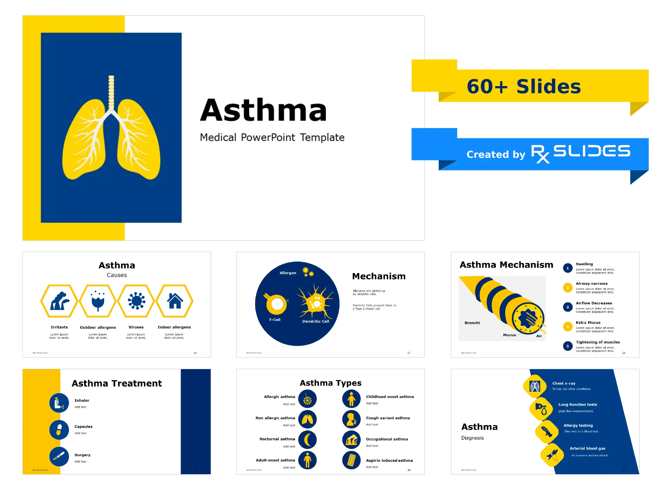 Download Asthma Pathophysiology PowerPoint TemplateRxSlides